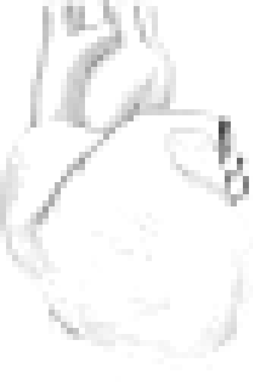 It's a contained heart